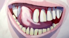 牙齒 teeth
